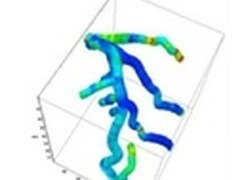 哈佛大学借助GPU计算排查心脏致命隐患