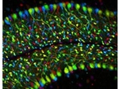 奥林巴斯杯全国显微图像大赛赛程延长