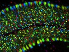 第四届奥林巴斯杯显微图像大赛奖项揭晓