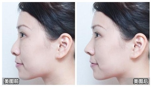 隆鼻丰胸染发 牛人的美图秀秀另类玩法