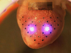 科学家用3D打印为心脏定制“防护服”