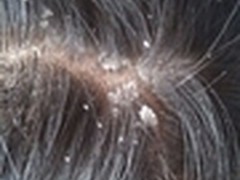 韩伊洗发水,真正去屑止痒