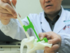 3D打印来了 骨科手术实现“私人定制”