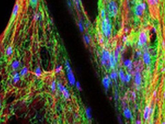 科学家3D打印出类似自然生长的人类软骨