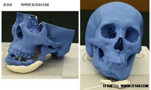 日本NEXT21公司将3D打印人工骨销往欧洲