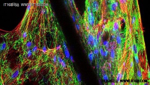 科学家3D打印出类似自然生长的人类软骨