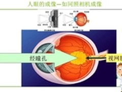 眼疾不可逆转！护眼6岁开始！