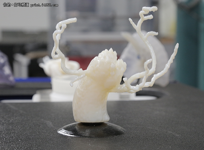 3D打印人体器官 提升医疗健康水平