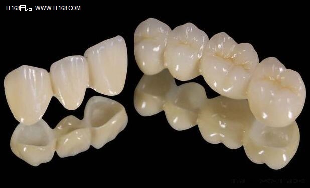 3D打印牙齿技术又有新突破 降费提效！