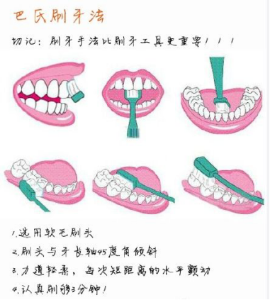 上京东买KKC电动牙刷送笔记本电脑