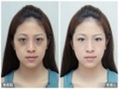 美图秀秀消除熬夜黑眼圈 每天神采奕奕