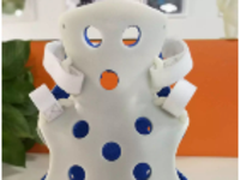 3D打印外固定支具，帮助小患者恢复健康