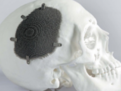 金属3D打印的魅力---多孔结构