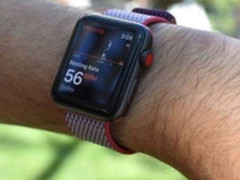 苹果新专利 Apple Watch可以用来测血压