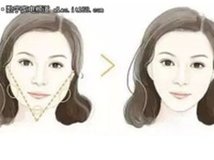 SKG射频仪拯救衰老松弛脸 U脸变V脸的秘密