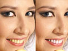 Photoshop色阶工具漂白人物牙齿技巧