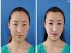 PS整容术技法丑女到美女的蜕变全记录